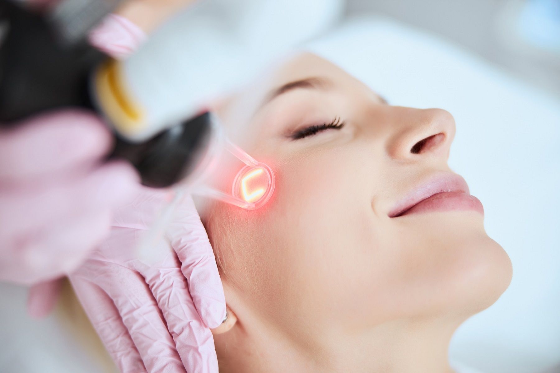 What Can You Expect During the Halo Hybrid Fractional Laser Treatment?